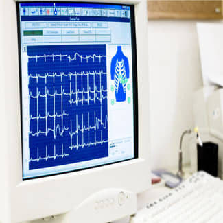 Gebruik van MRI- of CT-scan voorkomt onnodige hartkatheterisaties