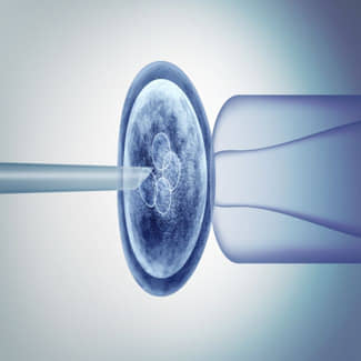 Genetische afwijkingen in embryo’s met alles in ééntest onderzocht